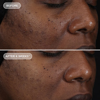 Ageless | Retinol 0.3% + Repair Creme
