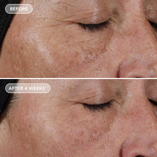 Ageless | Pure Liquid Retinol 0.1%