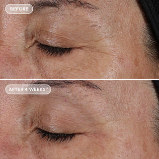 Ageless | Pure Liquid Retinol 0.1%