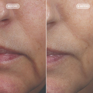 VOL.U.LIFT™ Sculpt & Restore Duo
