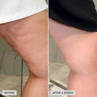 VOL.U.LIFT™ Sculpt & Restore Duo