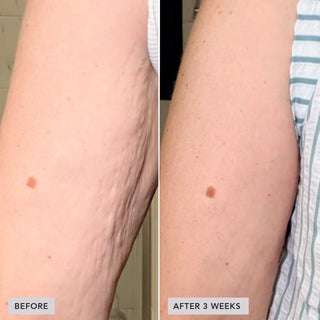VOL.U.LIFT™ Sculpt & Restore Duo