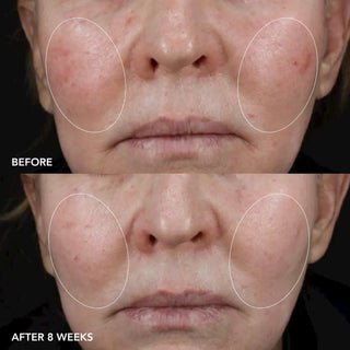 ImageMD | Longevity Creme