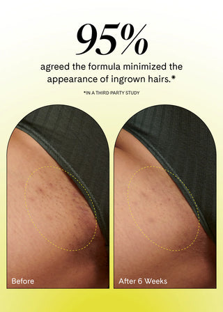 Fur | Ingrown Eliminator Serum Rollerball